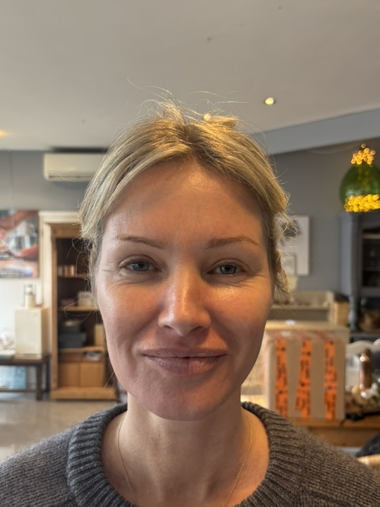 Sharon before - face